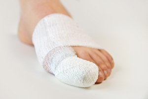 How to Tell if You’ve Broken Your Toe