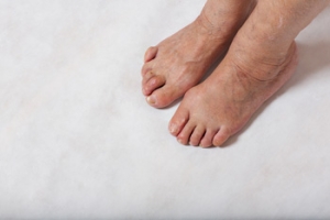 When a Hammertoe Causes Toe Pain