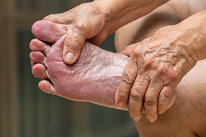 Dealing with Cavus Foot