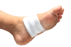 Prompt Treatment Is Necessary For Existing Wounds On The Feet