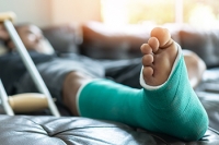 Causes, Symptoms, and Path to Recovery for a Broken Foot