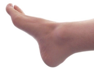 Dealing with Plantar Warts