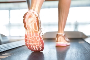 What Is Tarsal Tunnel Syndrome?