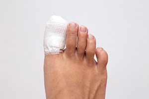 What Is Tennis Toe?