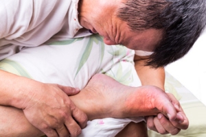 Gout Pain and the Big Toe