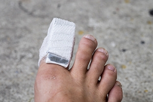 Complications of a Broken Toe