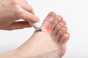 Athlete’s Foot in the Laundry