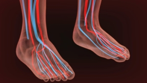 Risk Factors for Peripheral Artery Disease