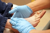 Diabetes and the Risks to Your Feet
